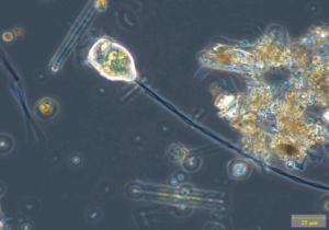 stalked ciliate in river water sample